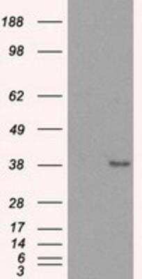Western Blot: Sorbitol Dehydrogenase Antibody (OTI9E7) [NBP2-02126]