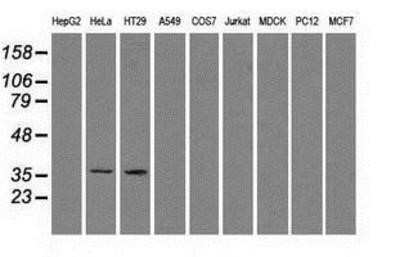 Western Blot: Sorbitol Dehydrogenase Antibody (OTI9E7)Azide and BSA Free [NBP2-74288]