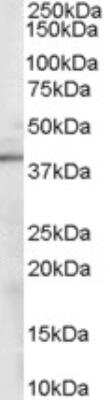 Western Blot: Sorbitol Dehydrogenase Antibody [NB100-1486]
