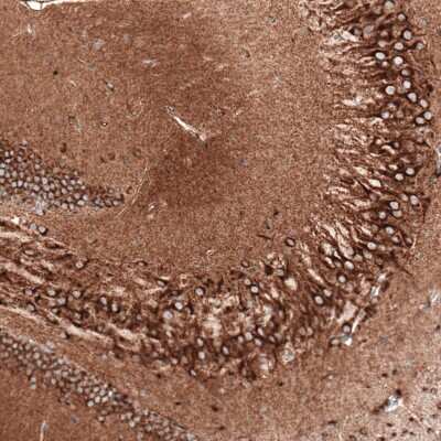 Immunohistochemistry-Paraffin: Sortilin Antibody (CL6526) [NBP2-76498]