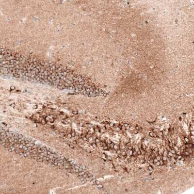 Immunohistochemistry-Paraffin: Sortilin Antibody (CL6528) [NBP2-76501]