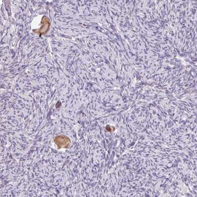 Immunohistochemistry: Sorting Nexin 31 Antibody [NBP2-49084]