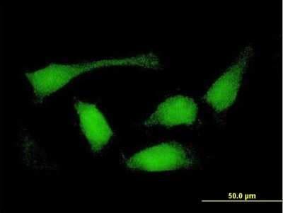 Immunocytochemistry/ Immunofluorescence: Sorting Nexin 32 Antibody [H00254122-B01P]