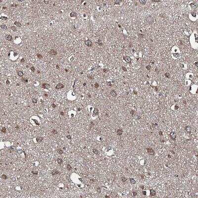Immunohistochemistry: Sorting Nexin 32 Antibody [NBP1-92424]