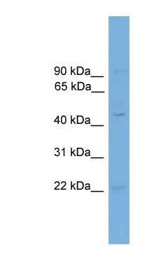 Western Blot: Sorting Nexin 32 Antibody [NBP1-79592]