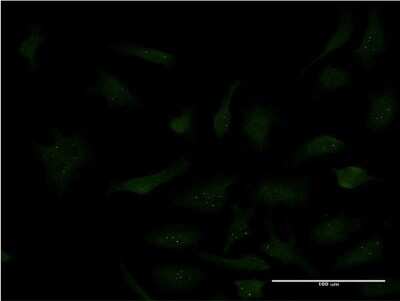 Immunocytochemistry/ Immunofluorescence: Sp3 Antibody (4E5) [H00006670-M09]