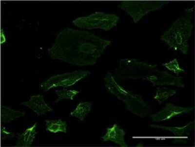 Immunocytochemistry/ Immunofluorescence: Spastin Antibody (2F5) [H00006683-M02]