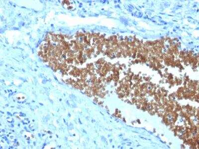 Immunohistochemistry-Paraffin: Spectrin alpha 1 Antibody (SPTA1/1832) - Azide and BSA Free [NBP2-79906]