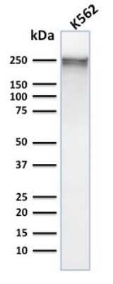 Western Blot: Spectrin alpha 1 Antibody (SPTA1/1832) [NBP2-79772]
