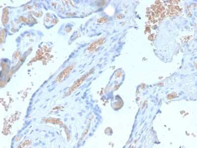 Immunohistochemistry-Paraffin: Spectrin alpha 1 Antibody (SPTA1/2939R) [NBP3-07265]