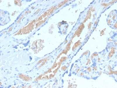 Immunohistochemistry-Paraffin: Spectrin alpha 1 Antibody (SPTA1/2939R) [NBP3-07265]