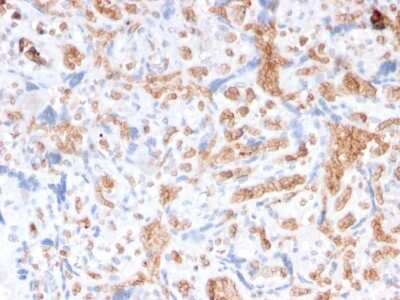 Immunohistochemistry-Paraffin: Spectrin alpha 1 Antibody (rSPTA1/1832) [NBP3-07855]