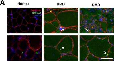Immunohistochemistry: Spectrin beta 1 Antibody (4C3) [NB300-574]