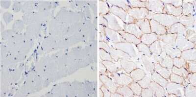 Immunohistochemistry-Paraffin: Spectrin beta 1 Antibody (4C3) [NB300-574]