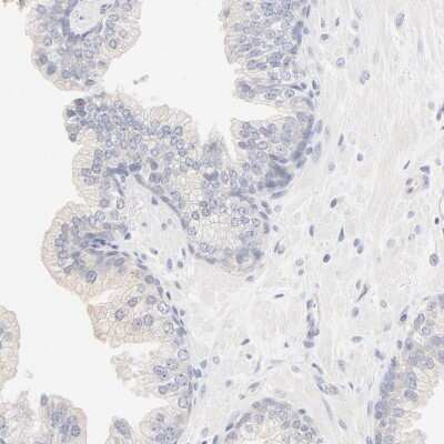 Immunohistochemistry-Paraffin: Spectrin beta 1 Antibody [NBP1-90350]