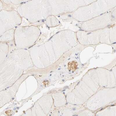 Immunohistochemistry-Paraffin: Spectrin beta 1 Antibody [NBP1-90350]