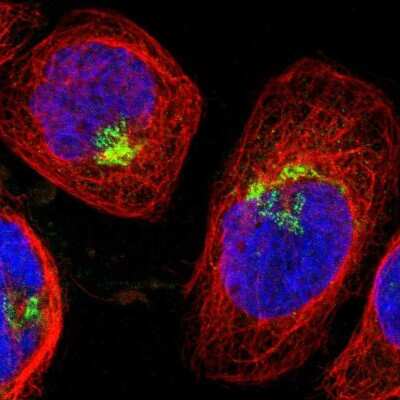 Immunocytochemistry/ Immunofluorescence: Spectrin beta 2 Antibody [NBP1-86088]