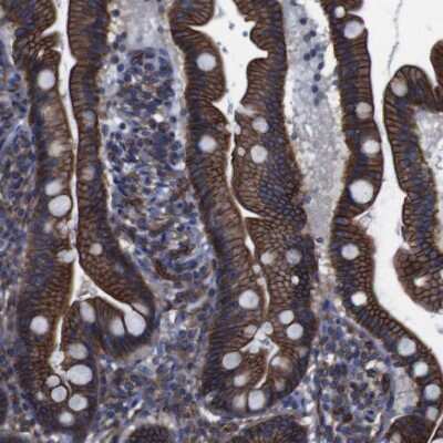 Immunohistochemistry-Paraffin: Spectrin beta 2 Antibody [NBP1-86468]