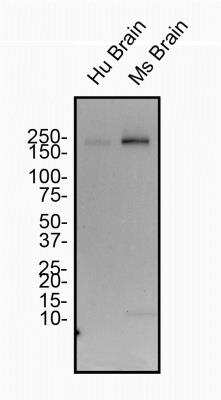 Western Blot: Spectrin beta 3 Antibody (1287A)Azide and BSA Free [NBP2-59668]