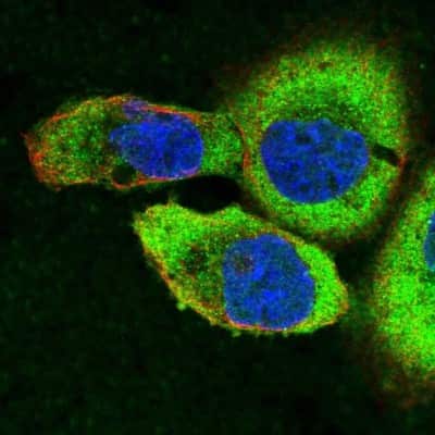 Immunocytochemistry/ Immunofluorescence: Spectrin beta 3 Antibody [NBP2-48703]