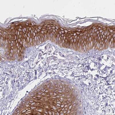 Immunohistochemistry-Paraffin: Spectrin beta 3 Antibody [NBP2-48703]