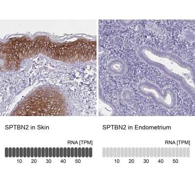 Immunohistochemistry-Paraffin: Spectrin beta 3 Antibody [NBP2-48703]