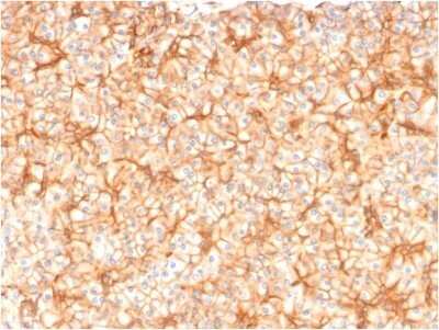 Immunohistochemistry-Paraffin: Spectrin beta 3 Antibody (SPTBN2/1582) - Azide and BSA Free [NBP2-54488]