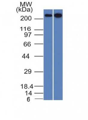 Western Blot: Spectrin beta 3 Antibody (SPTBN2/1582)Azide and BSA Free [NBP2-54488]