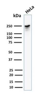 Western Blot: Spectrin beta 3 Antibody (SPTBN2/1582) [NBP2-53236]