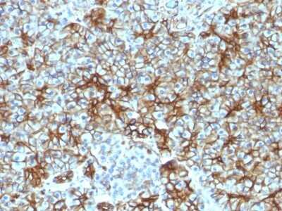 Immunohistochemistry-Paraffin: Spectrin beta 3 Antibody (SPTBN2/1583) - Azide and BSA Free [NBP2-54440]