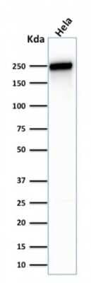 Western Blot: Spectrin beta 3 Antibody (SPTBN2/1583) [NBP2-53312]