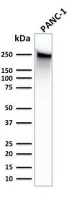 Western Blot: Spectrin beta 3 Antibody (SPTBN2/1583) [NBP2-53312]