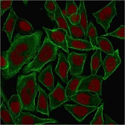 Immunocytochemistry/ Immunofluorescence: Spectrin beta 3 Antibody (SPTBN2/1584) - Azide and BSA Free [NBP2-54439]