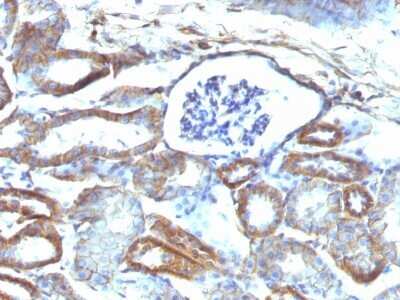 Immunohistochemistry-Paraffin: Spectrin beta 3 Antibody (SPTBN2/1584) - Azide and BSA Free [NBP2-54439]