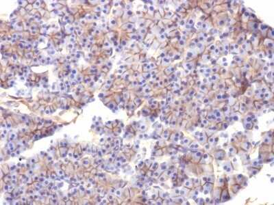Immunohistochemistry-Paraffin: Spectrin beta 3 Antibody (SPTBN2/1584) - Azide and BSA Free [NBP2-54439]