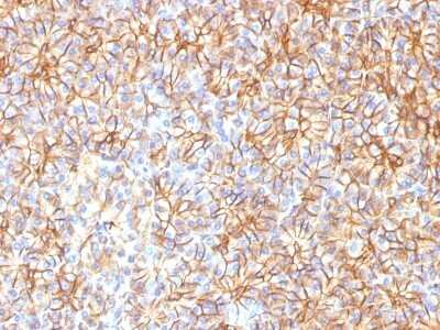 Immunohistochemistry-Paraffin: Spectrin beta 3 Antibody (SPTBN2/1584) [NBP2-53315]