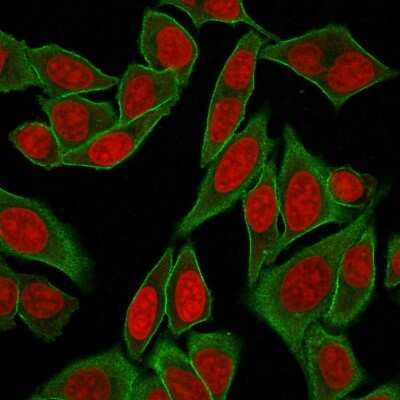 Immunocytochemistry/ Immunofluorescence: Spectrin beta 3 Antibody (SPTBN2/2887R) - Azide and BSA Free [NBP3-08441]