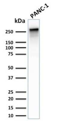 Western Blot: Spectrin beta 3 Antibody (SPTBN2/2887R) [NBP3-07293]