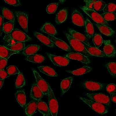 Immunocytochemistry/ Immunofluorescence: Spectrin beta 3 Antibody (SPTBN2/3142R) - Azide and BSA Free [NBP3-08442]