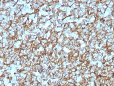 Immunohistochemistry-Paraffin: Spectrin beta 3 Antibody (SPTBN2/3142R) - Azide and BSA Free [NBP3-08442]