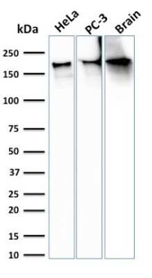 Western Blot: Spectrin beta 3 Antibody (SPTBN2/3142R)Azide and BSA Free [NBP3-08442]