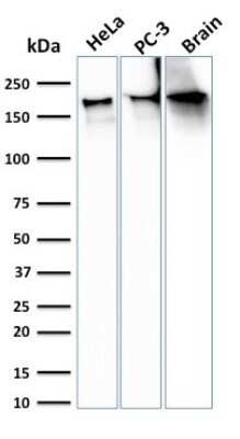 Western Blot: Spectrin beta 3 Antibody (SPTBN2/3142R) [NBP3-07294]