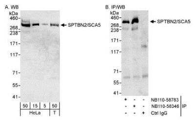 Western Blot: Spectrin beta 3 AntibodyBSA Free [NB110-58346]