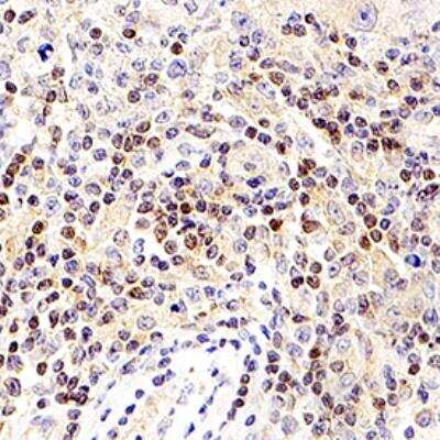 Immunohistochemistry-Paraffin: Speedy/Ringo Antibody [NB100-2521]