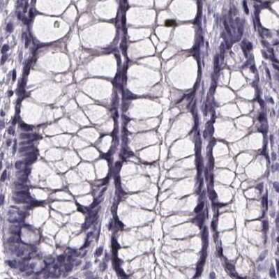 Immunohistochemistry-Paraffin: Sperm Flagellar 2 Antibody [NBP2-38461]
