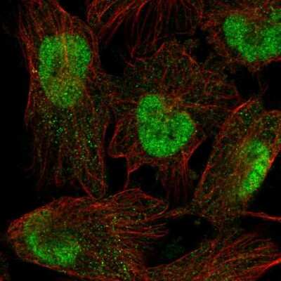 Immunocytochemistry/ Immunofluorescence: Sperm-associated antigen 7 Antibody [NBP2-56171]