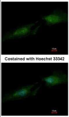Immunocytochemistry/ Immunofluorescence: Spermine synthase Antibody [NBP2-20470]