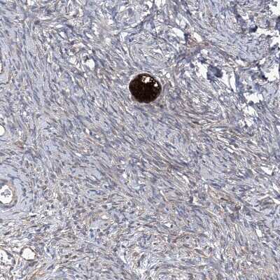 Immunohistochemistry-Paraffin: Spermine synthase Antibody [NBP1-87812]