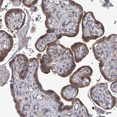 Immunohistochemistry-Paraffin: Spermine synthase Antibody [NBP1-87812]