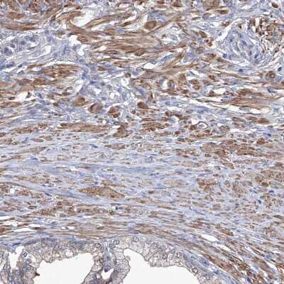 Immunohistochemistry-Paraffin: Spermine synthase Antibody [NBP1-87812]